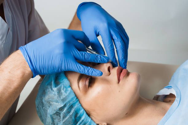 How Rhinoplasty Enhances Profile Balance?